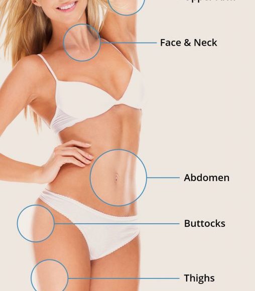 lipo-women-508×1024