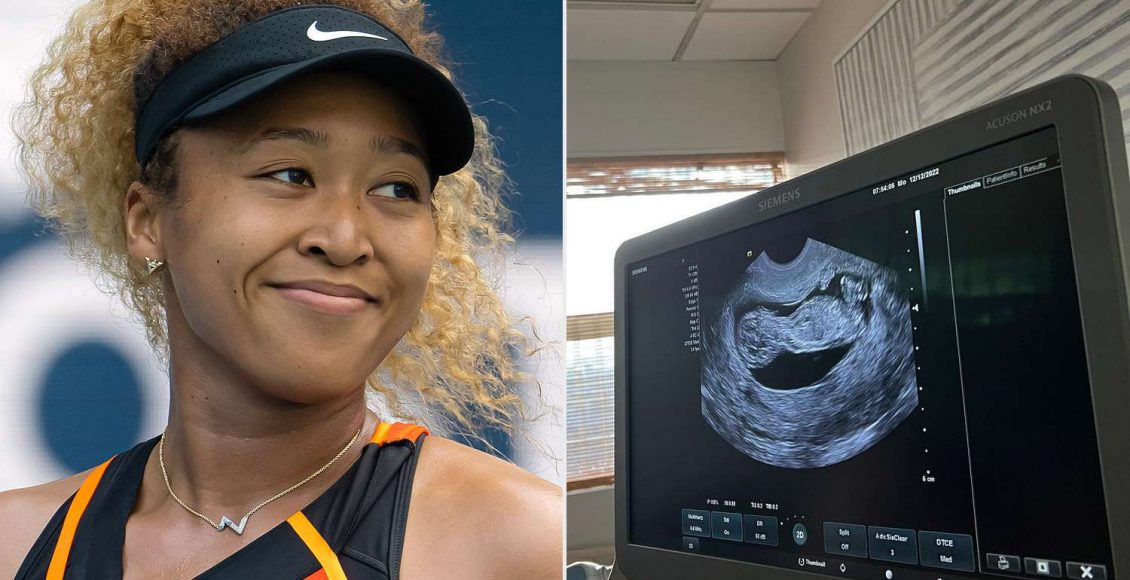 Naomi-Osaka-pregnant-011123-9a3ac1526bff4be39468467d94973456